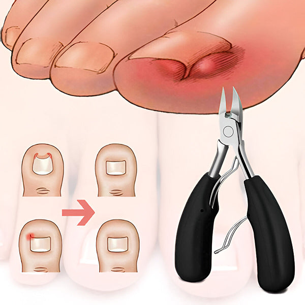 Premium Nagelverzorgingsset met Accessoires