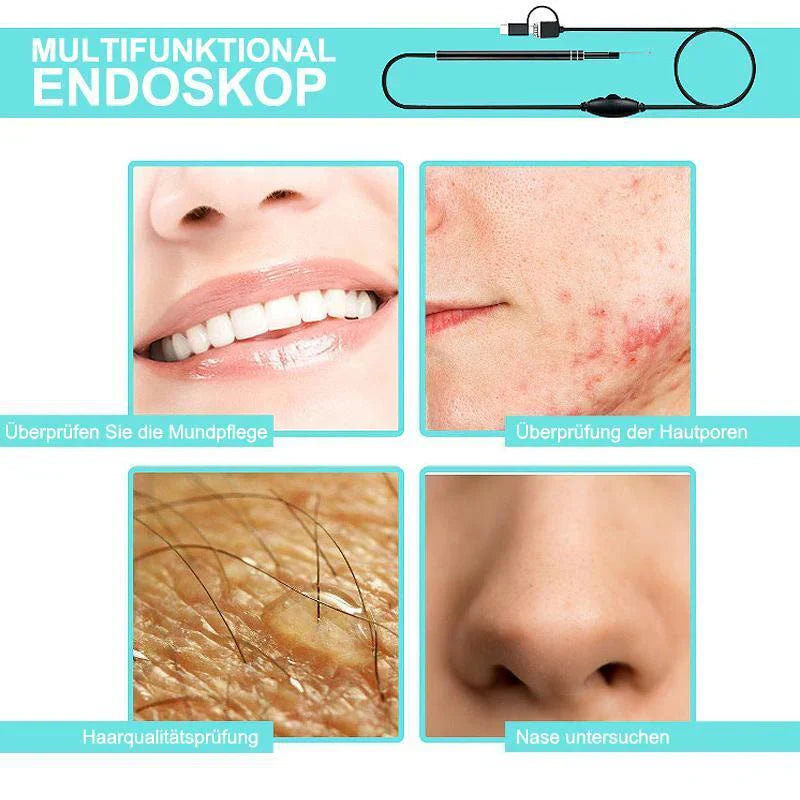 3-in-1 Endoscoop voor Oorreiniging
